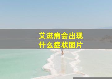 艾滋病会出现什么症状图片