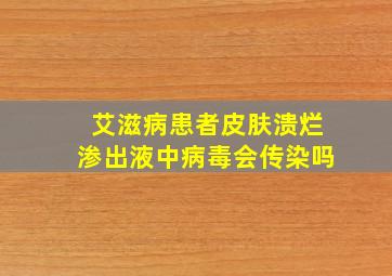 艾滋病患者皮肤溃烂渗出液中病毒会传染吗