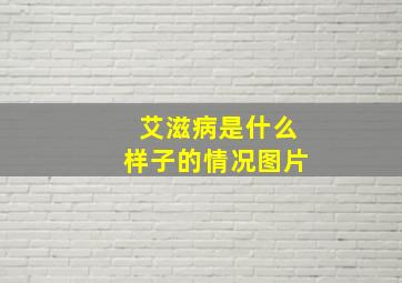 艾滋病是什么样子的情况图片