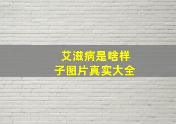 艾滋病是啥样子图片真实大全