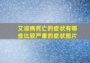 艾滋病死亡的症状有哪些比较严重的症状图片