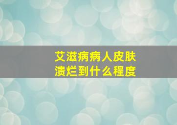 艾滋病病人皮肤溃烂到什么程度