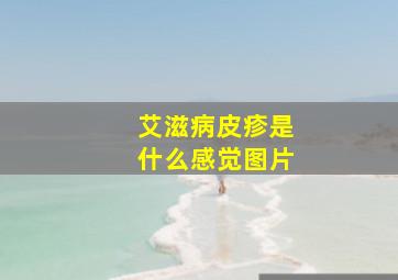 艾滋病皮疹是什么感觉图片