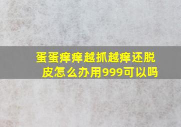 蛋蛋痒痒越抓越痒还脱皮怎么办用999可以吗