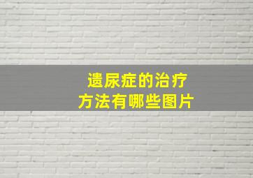 遗尿症的治疗方法有哪些图片