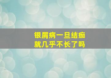 银屑病一旦结痂就几乎不长了吗