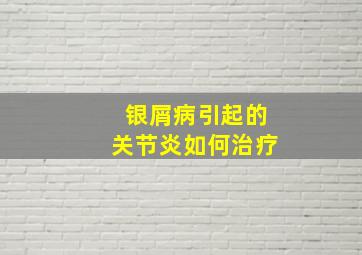 银屑病引起的关节炎如何治疗