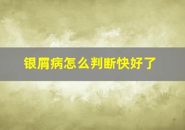 银屑病怎么判断快好了