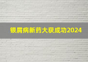 银屑病新药大获成功2024