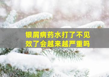 银屑病药水打了不见效了会越来越严重吗