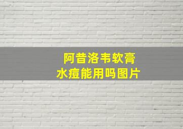 阿昔洛韦软膏水痘能用吗图片