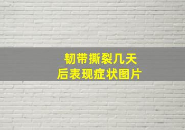 韧带撕裂几天后表现症状图片