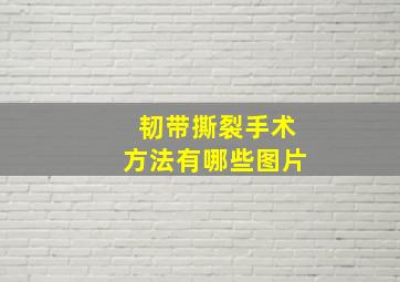 韧带撕裂手术方法有哪些图片