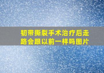 韧带撕裂手术治疗后走路会跟以前一样吗图片