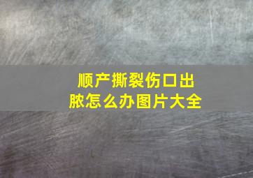 顺产撕裂伤口出脓怎么办图片大全