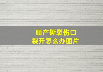 顺产撕裂伤口裂开怎么办图片