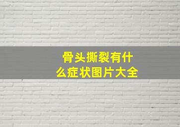 骨头撕裂有什么症状图片大全